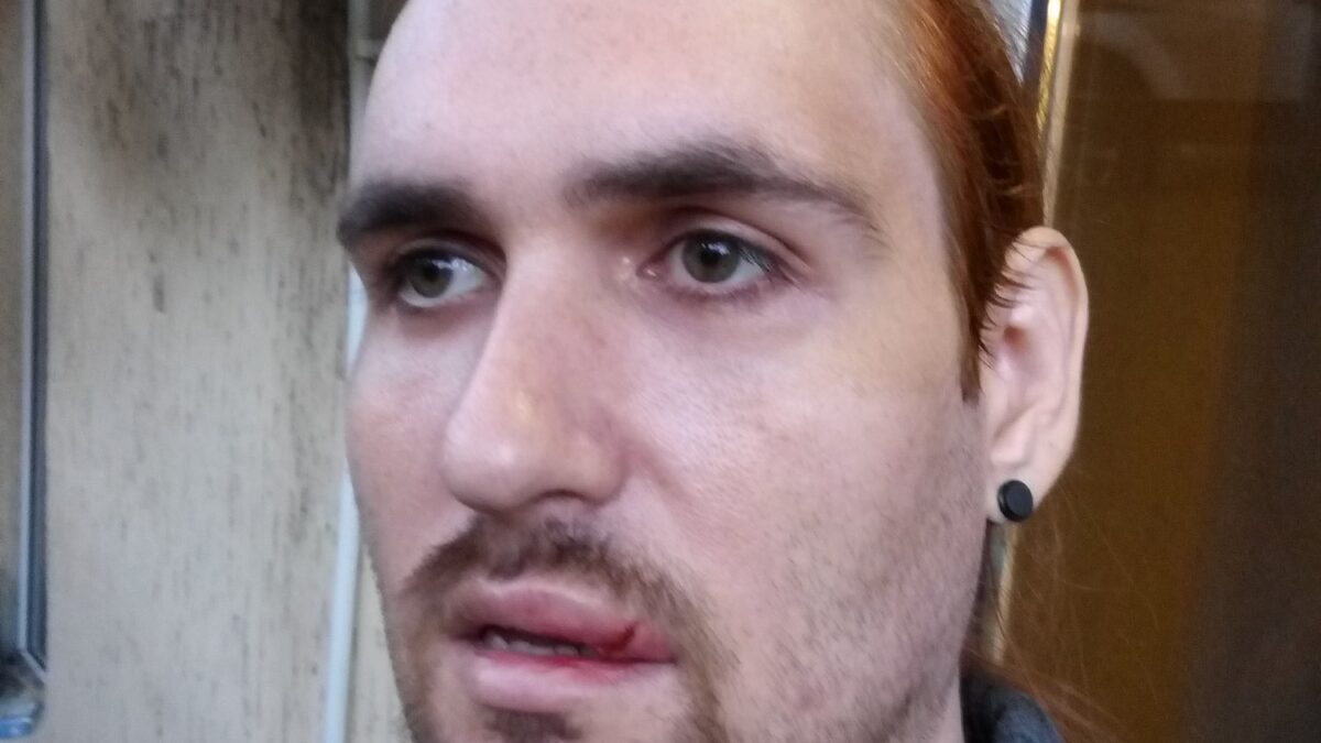 Совершено нападение на волонтера одесского QueerHome