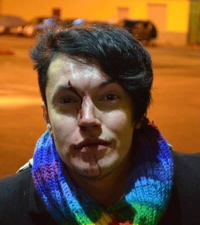 Петербургского гей-активиста избили в вагоне метро из-за радужного шарфа
