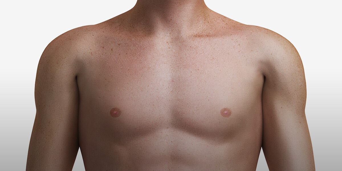Как живет человек, прошедший коррекцию пола