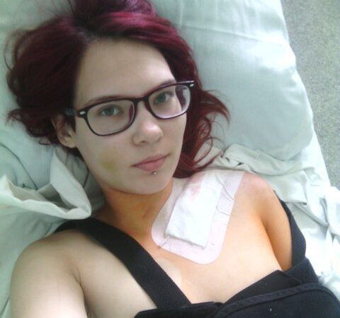 В Нижнем 19-летней девушке сломали ключицу за призыв к толерантности к геям