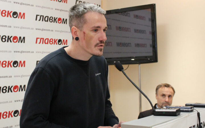В Одессе напали на ЛГБТ-активиста и его партнера. Правозащитники требуют расследования