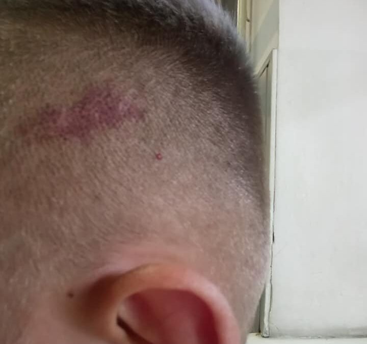 Совершено нападение на ветерана АТО – открытого гея Виктора Пилипенко