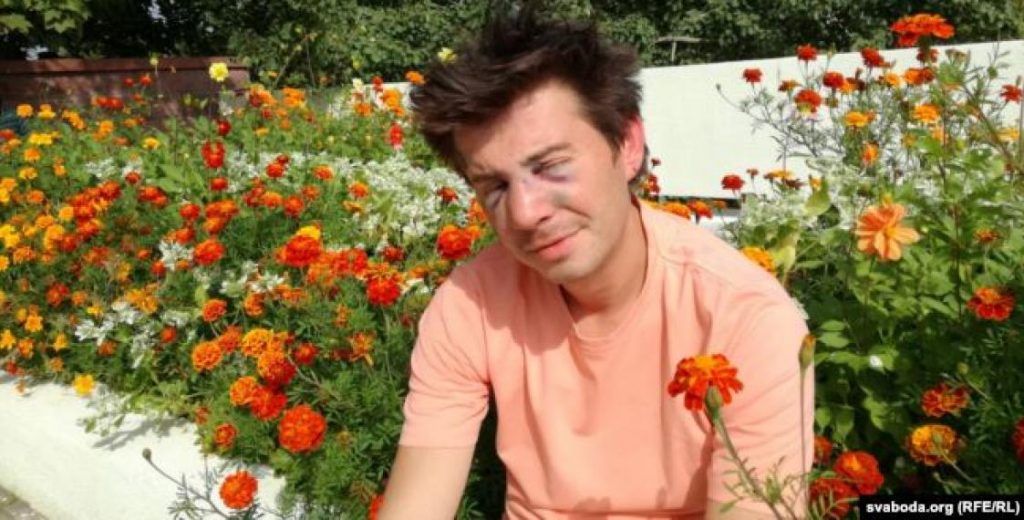 В Минске неизвестный напал на ЛГБТ-компанию, один пострадавший — в больнице