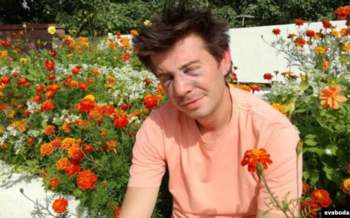 В Минске неизвестный напал на ЛГБТ-компанию, один пострадавший — в больнице