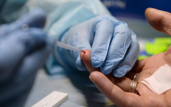 Количество случаев ВИЧ в Англии снизилось до рекордно низкого уровня