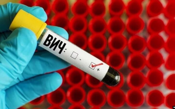 Ученые впервые за 20 лет обнаружили новый штамм ВИЧ у жителей Конго