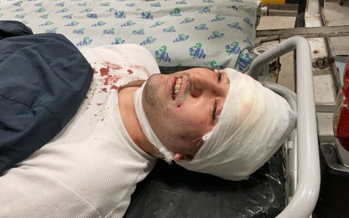 Представители ЛГБТ Узбекистана уходят в подполье после нападения на блогера