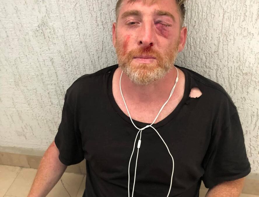 В Грузии скончался телеоператор, избитый гомофобами перед акцией в поддержку ЛГБТ