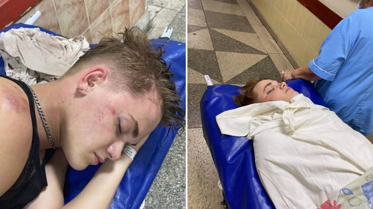 Танцор Дорофеевой, которого избили возле гей-клуба, пришел в себя