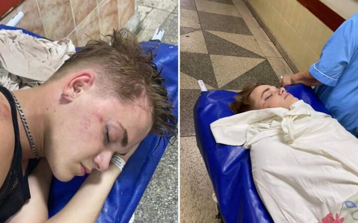 Танцор Дорофеевой, которого избили возле гей-клуба, пришел в себя
