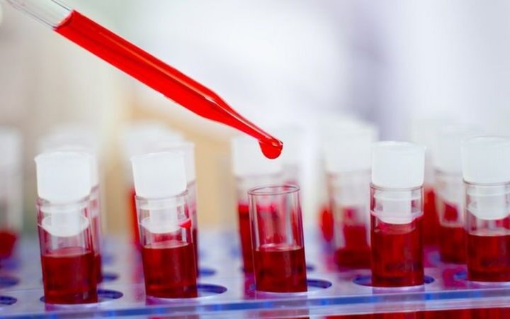 Жительница Аргентины избавилась от ВИЧ без лекарств. Это второй такой случай в истории