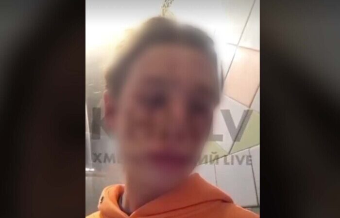 В Хмельницком подожгли волосы и лицо 18-летней трансгендерной девушки