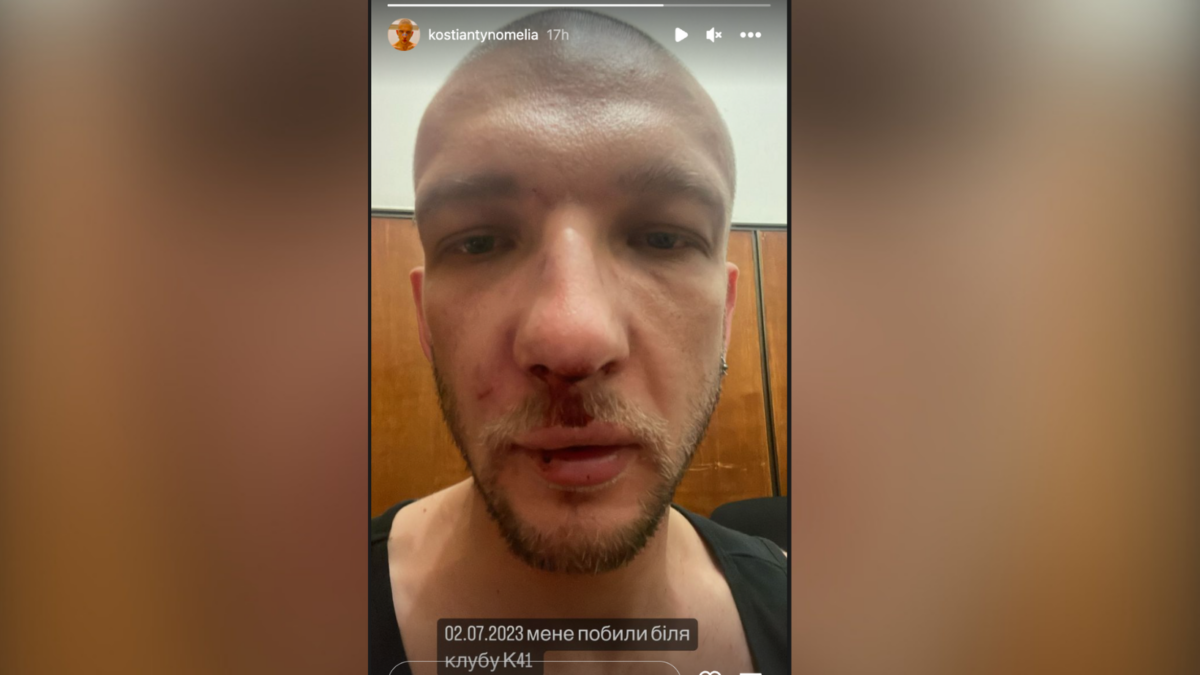 У Києві невідомі напали на дизайнера Костянтина Омелю: потерпілий вважає це злочином на ґрунті гомофобії