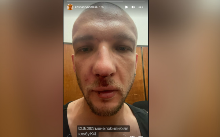У Києві невідомі напали на дизайнера Костянтина Омелю: потерпілий вважає це злочином на ґрунті гомофобії