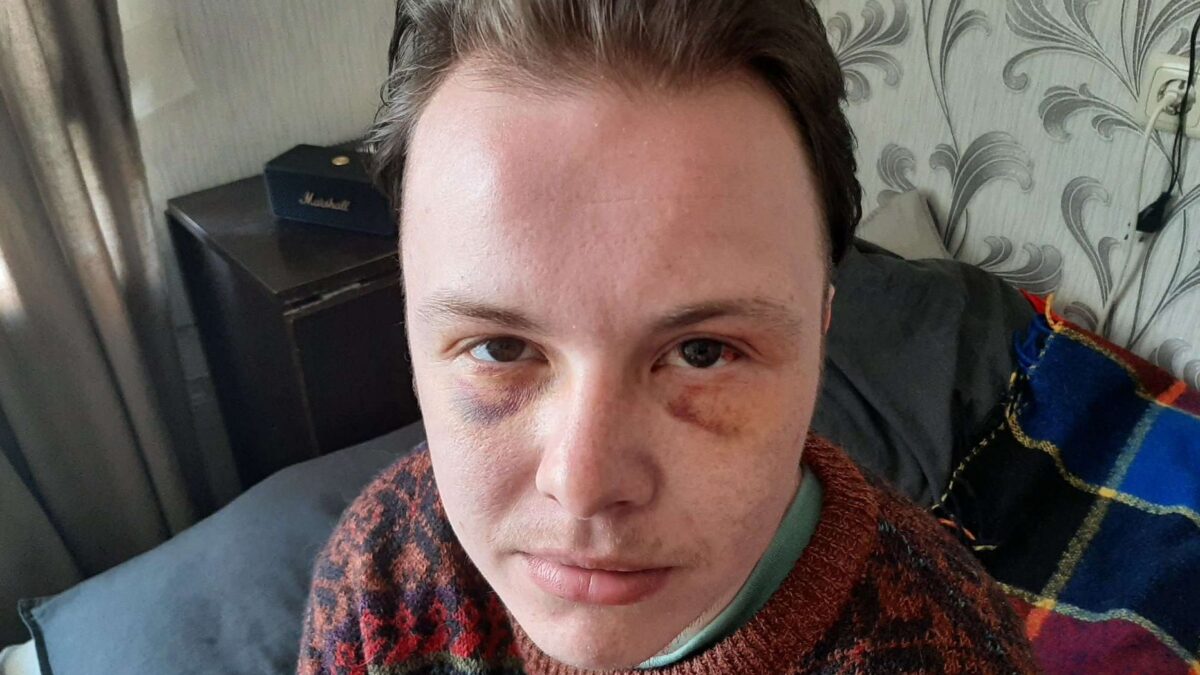 Справу про побиття ЛГБТ-активіста в Латвії передано до суду