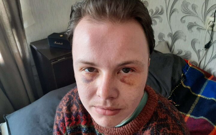Справу про побиття ЛГБТ-активіста в Латвії передано до суду