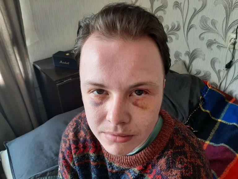 Справу про побиття ЛГБТ-активіста в Латвії передано до суду