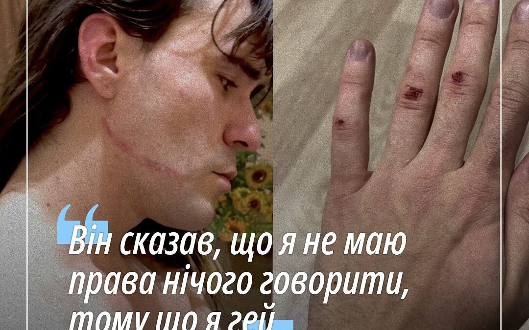 Оновлені дані щодо нападу на митця Даніеля Скрипника