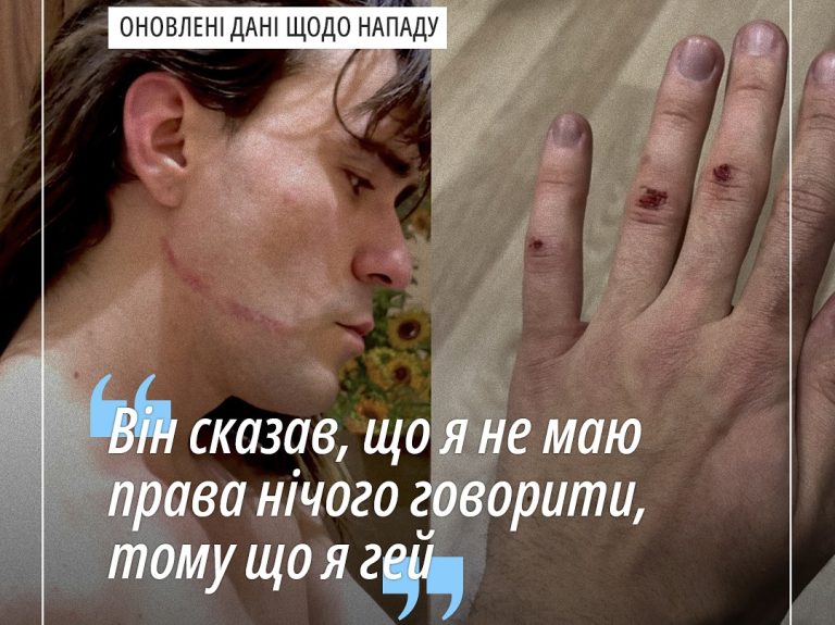Оновлені дані щодо нападу на митця Даніеля Скрипника